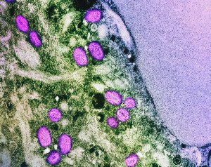 Gut Print Eating: Crafting Your Microbiome's Unique Menu for Optimal Health